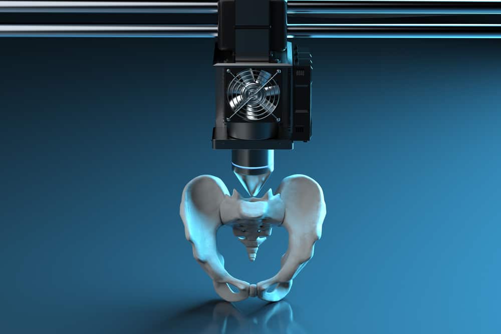 3D printer printing prosthetic hip bone