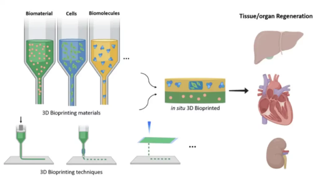 The concept of 3D bioprinting